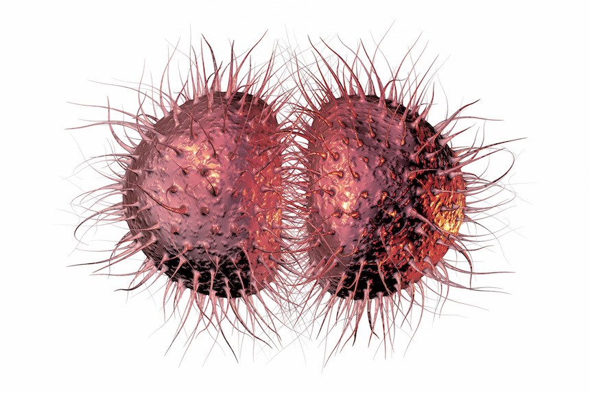 gonorrea