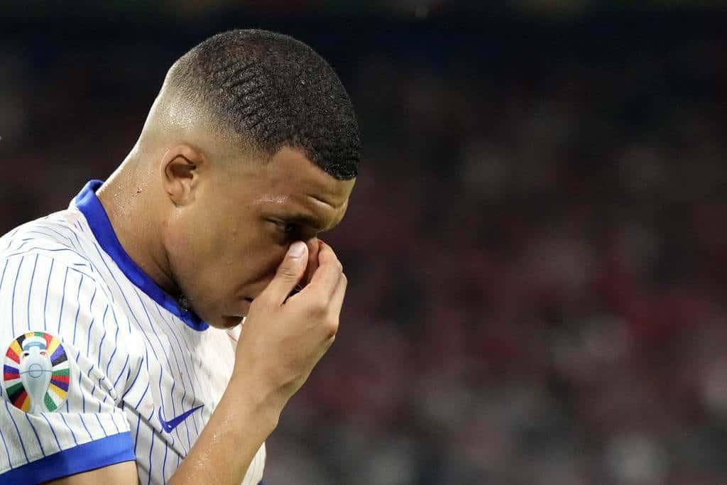 kylian mbappe sufre fractura en la nariz en la euro 2024 focus 0 0 1044 675